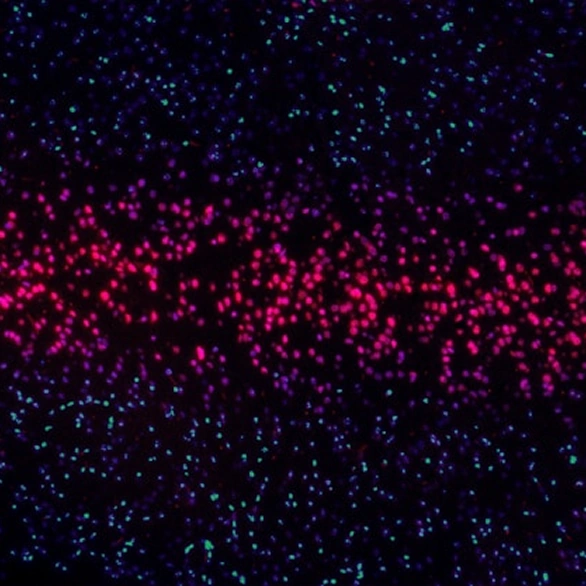 Learning Needs Analysis